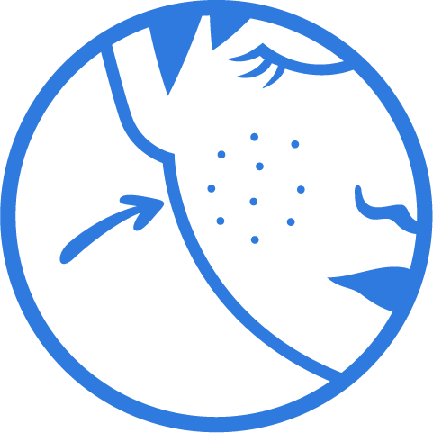 clearing acne icon