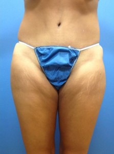 After